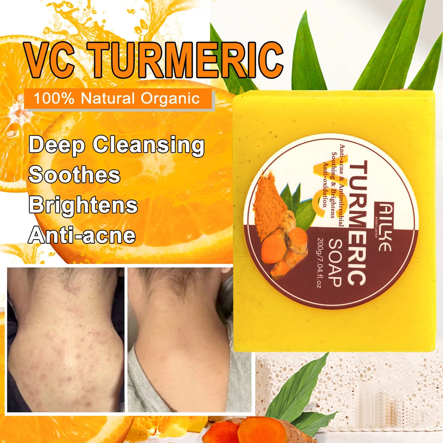 AILKE Natural Turmeric Soap Bar, Brighten, Remove Darkness, Acne, Pimples, Cleaning, Exfoliates, Uneven Skin Tone, 200g